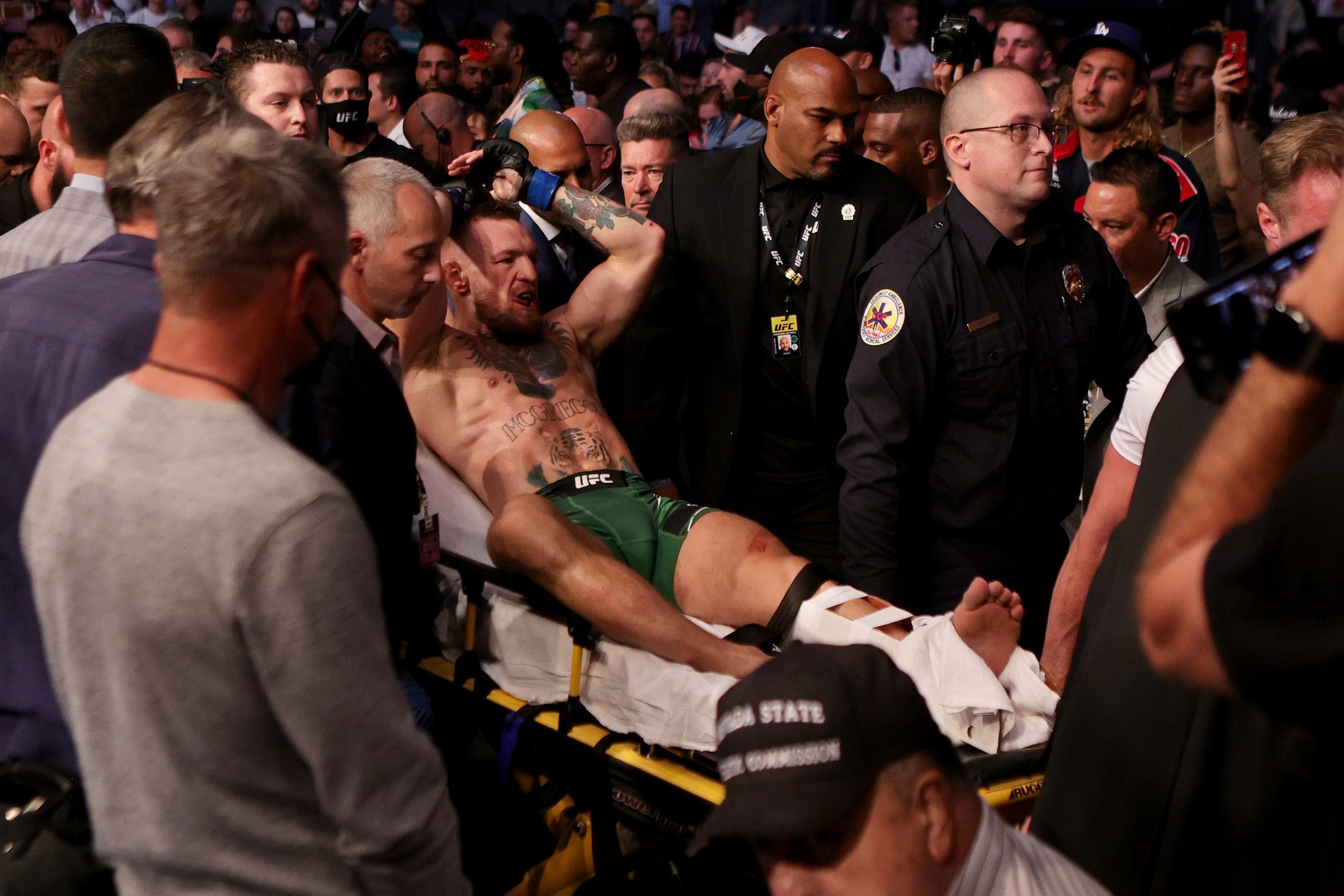 Conor McGregor schwer verletzt