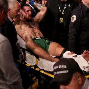 Conor McGregor schwer verletzt