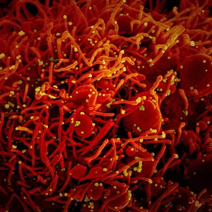 Eine mit dem Coronavirus infizierte Zelle