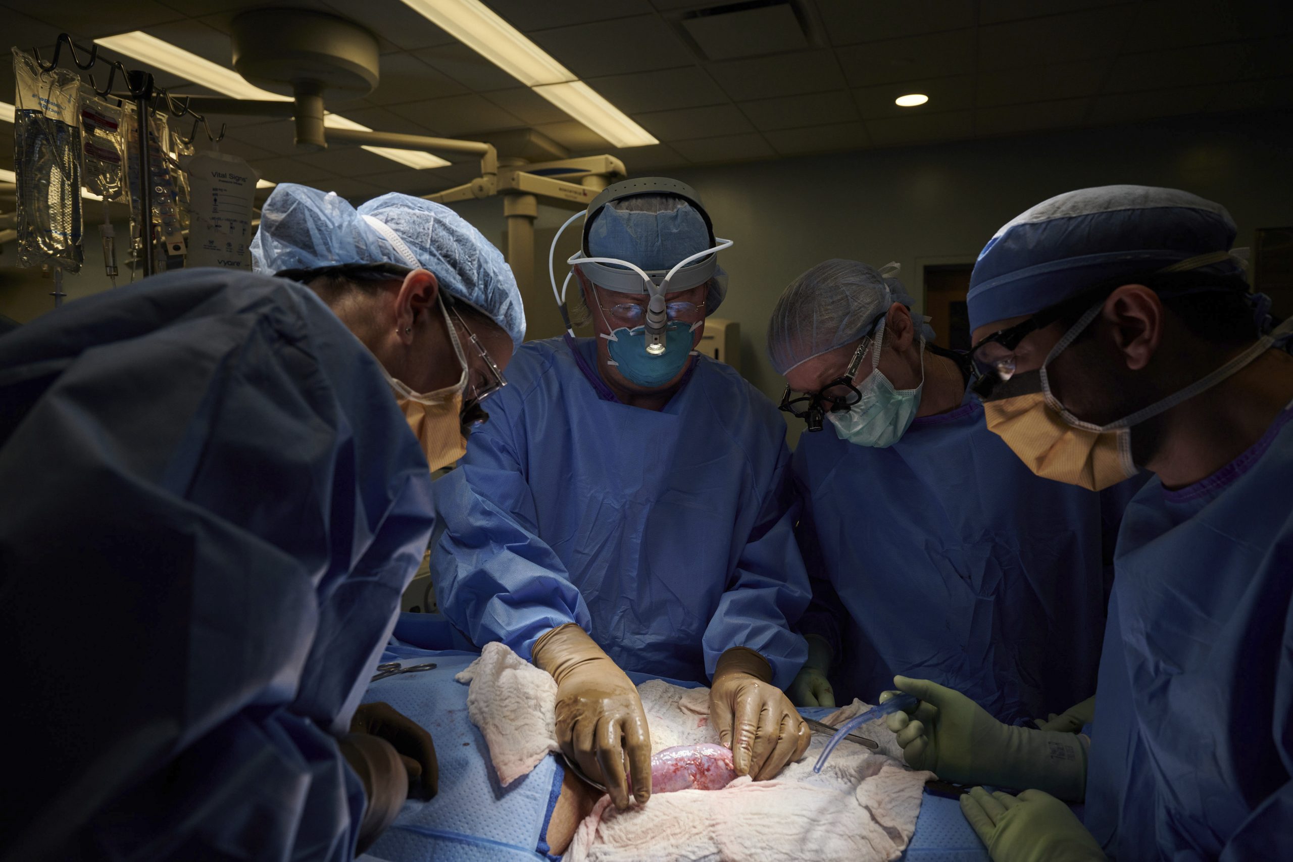 Das Chirurgen-Team bei der Transplantation der Schweineniere.
