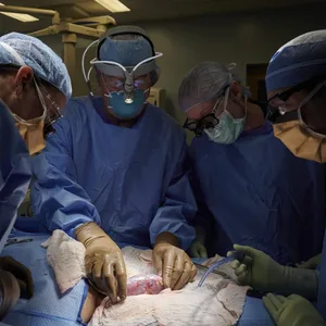 Das Chirurgen-Team bei der Transplantation der Schweineniere.