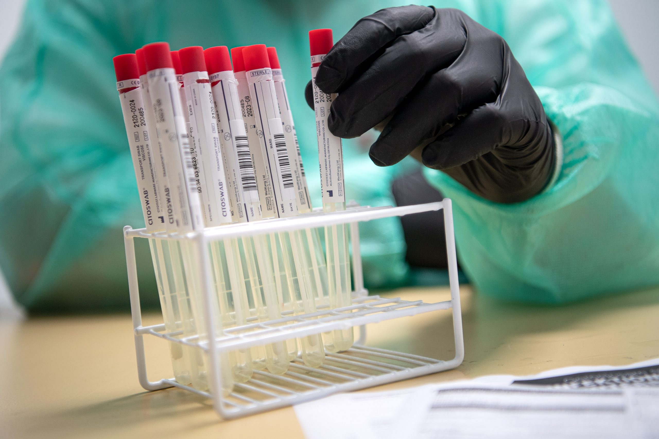 Proben für eine PCR-Test (Symbolbild). In einer Hamburger Klinik haben sich zehn Personen mit Corona infiziert.