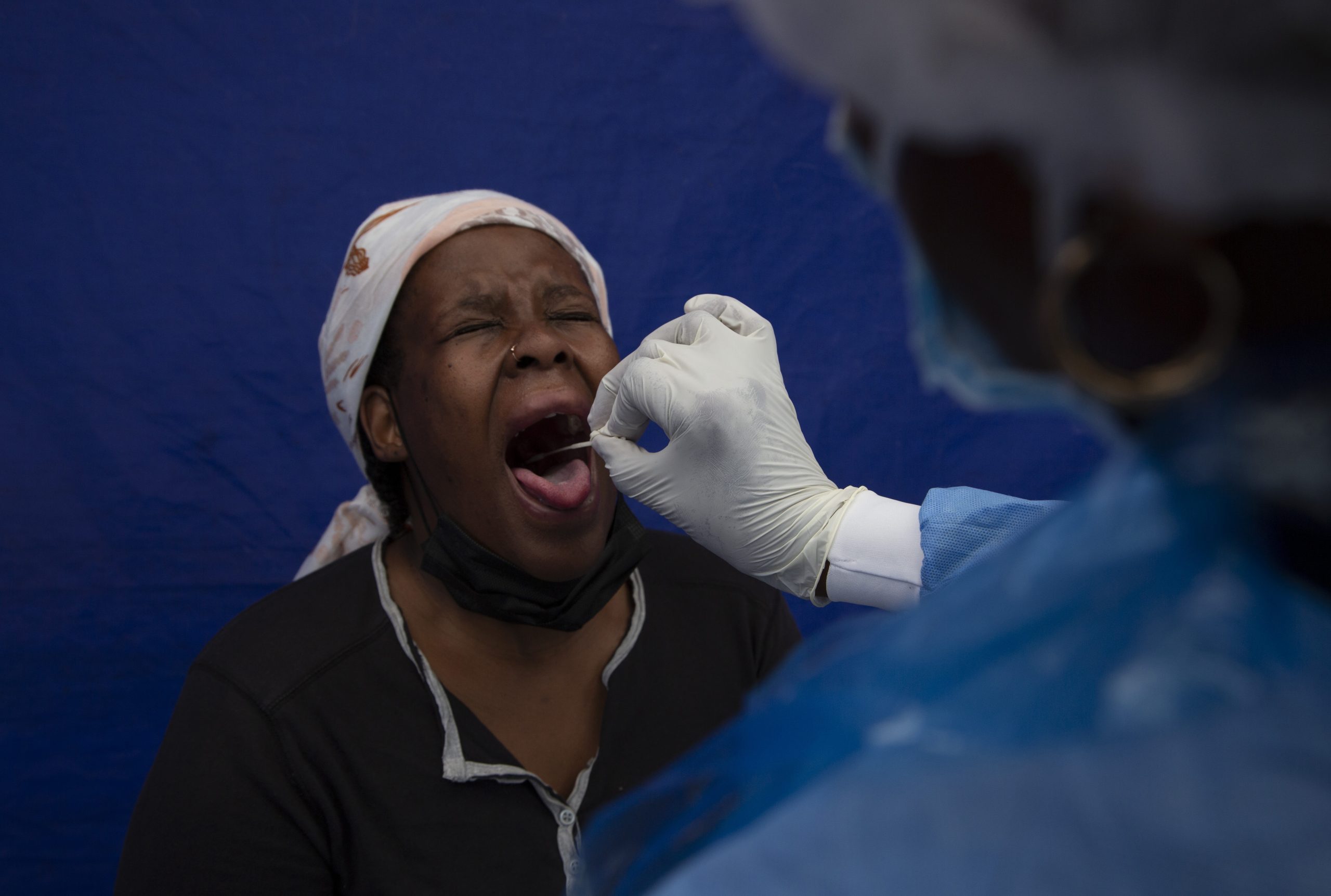 Einer Frau in Soweto in Südafrika wird ein Rachenabstrich entnommen.