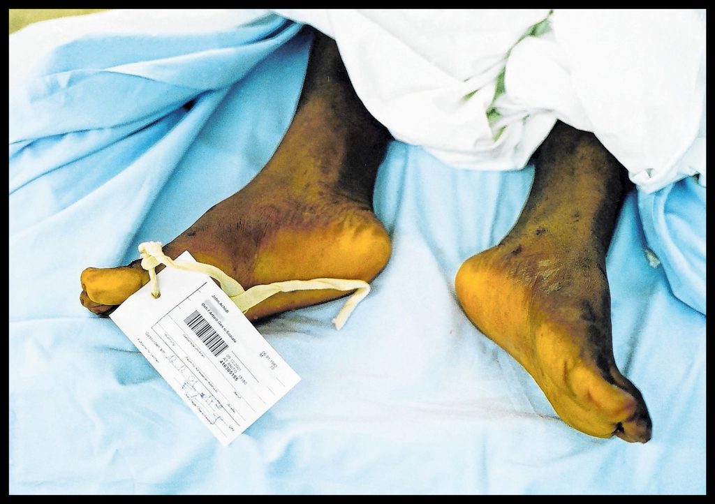 Ein Toter in der Gerichtsmedizin.