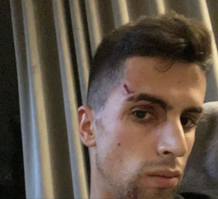 Cancelo