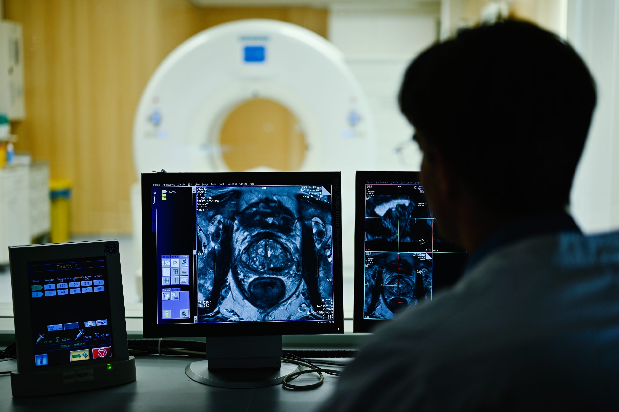 Ein Mitarbeiter des Deutschen Krebsforschungszentrum (DKFZ) betrachtet das Querschnittsbild einer Prostata. Wegen der Pandemie gehen weniger Menschen zur Vorsorge.