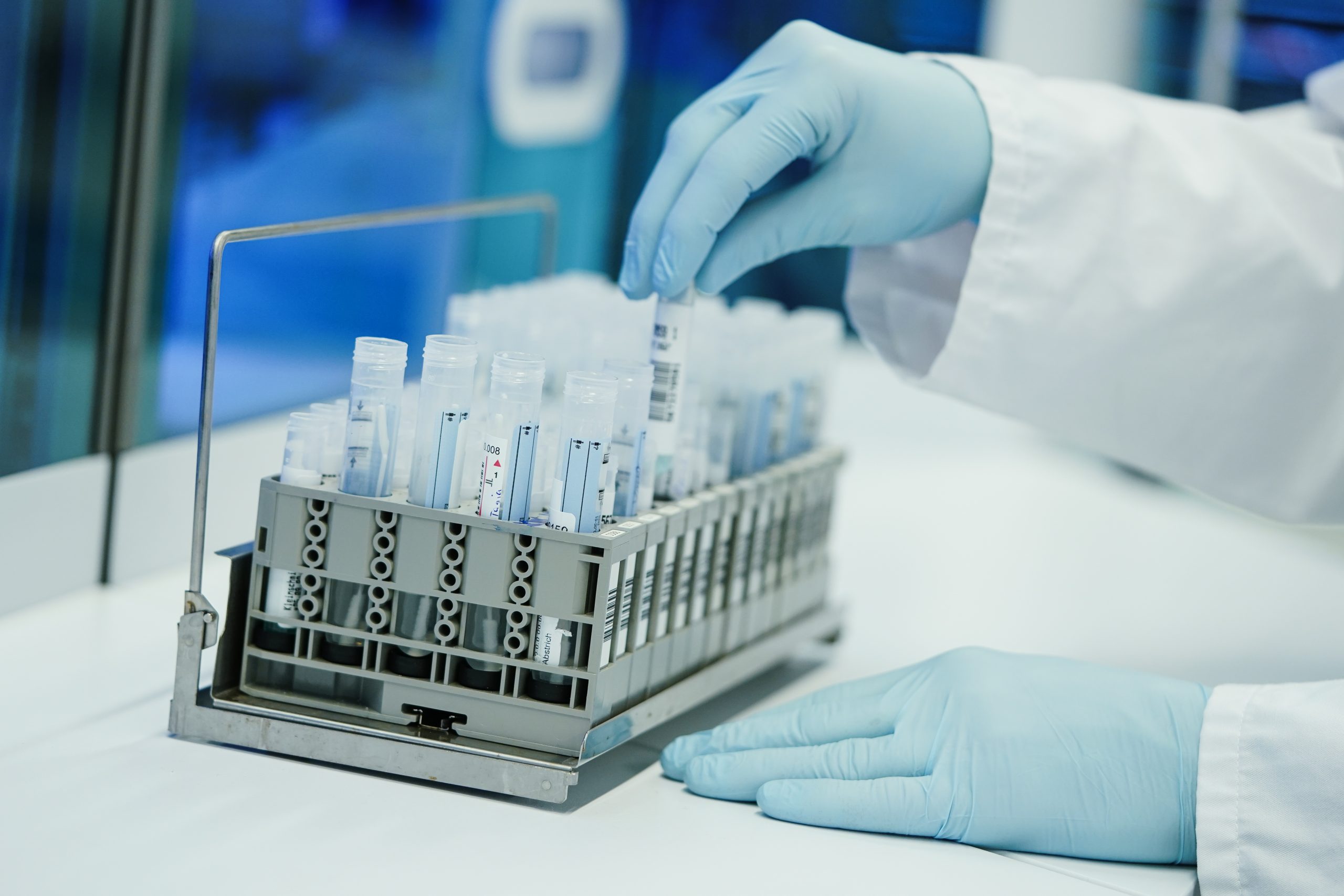 Ein Mitarbeiter hält in einem Coronatest-Labor der Limbach Gruppe PCR-Teströhrchen in den Händen.
