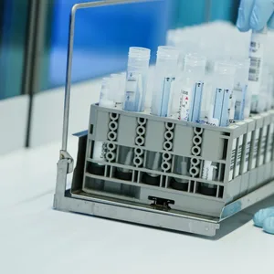 Ein Mitarbeiter hält in einem Coronatest-Labor der Limbach Gruppe PCR-Teströhrchen in den Händen.