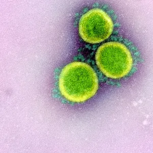 Das Coronoavirus SARS-CoV-2 unter dem Mikroskop (Symbolbild).