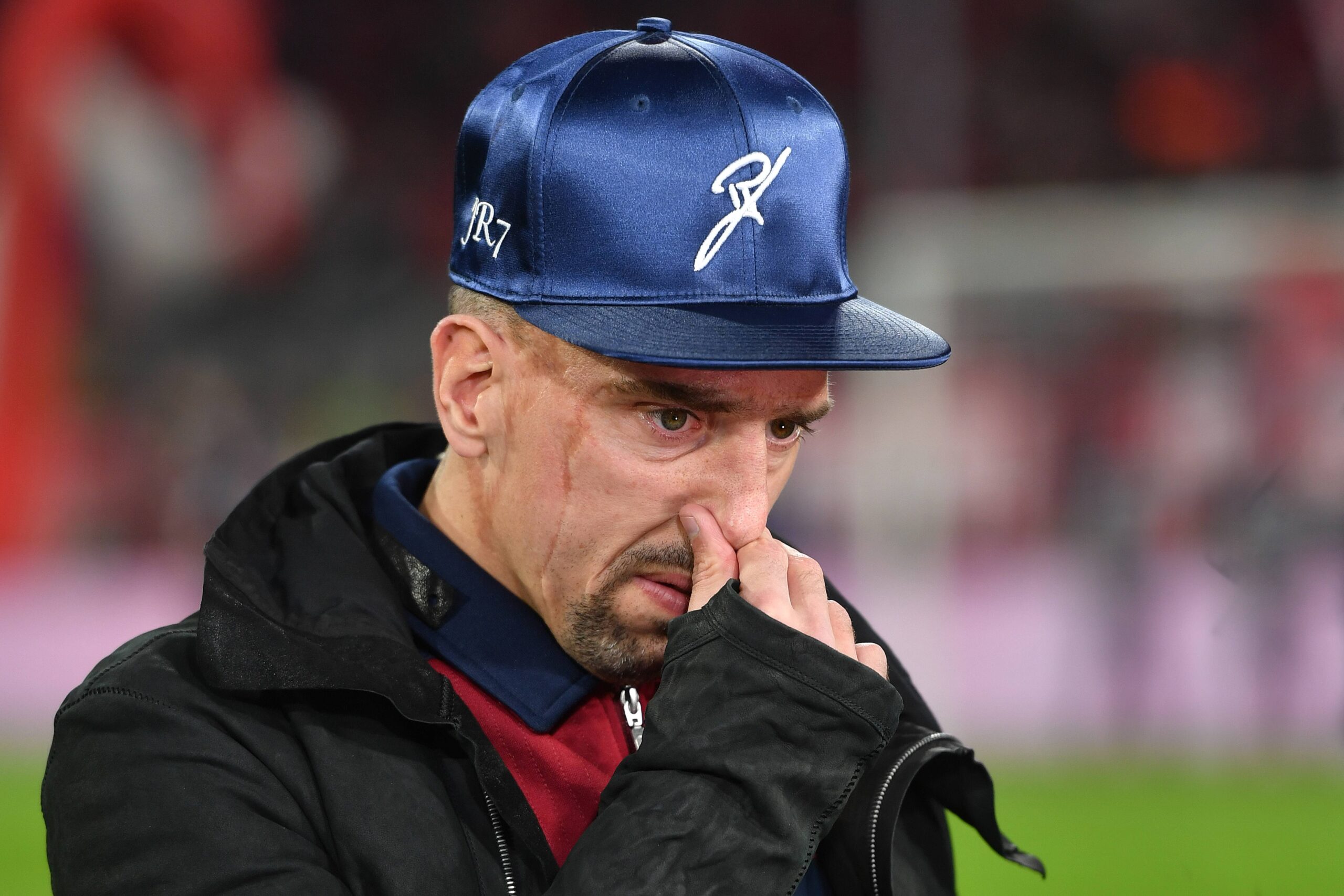 Franck Ribéry hat bei einem Autounfall eine leichte Gehirnerschütterung erlitten.