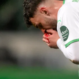 Autsch! Fürths Maximilian Bauer hält sich den blutenden Mund.