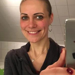 Kurz nach der Chemotherapie: Yvonne Deharde kämpfte gegen Brustkrebs.