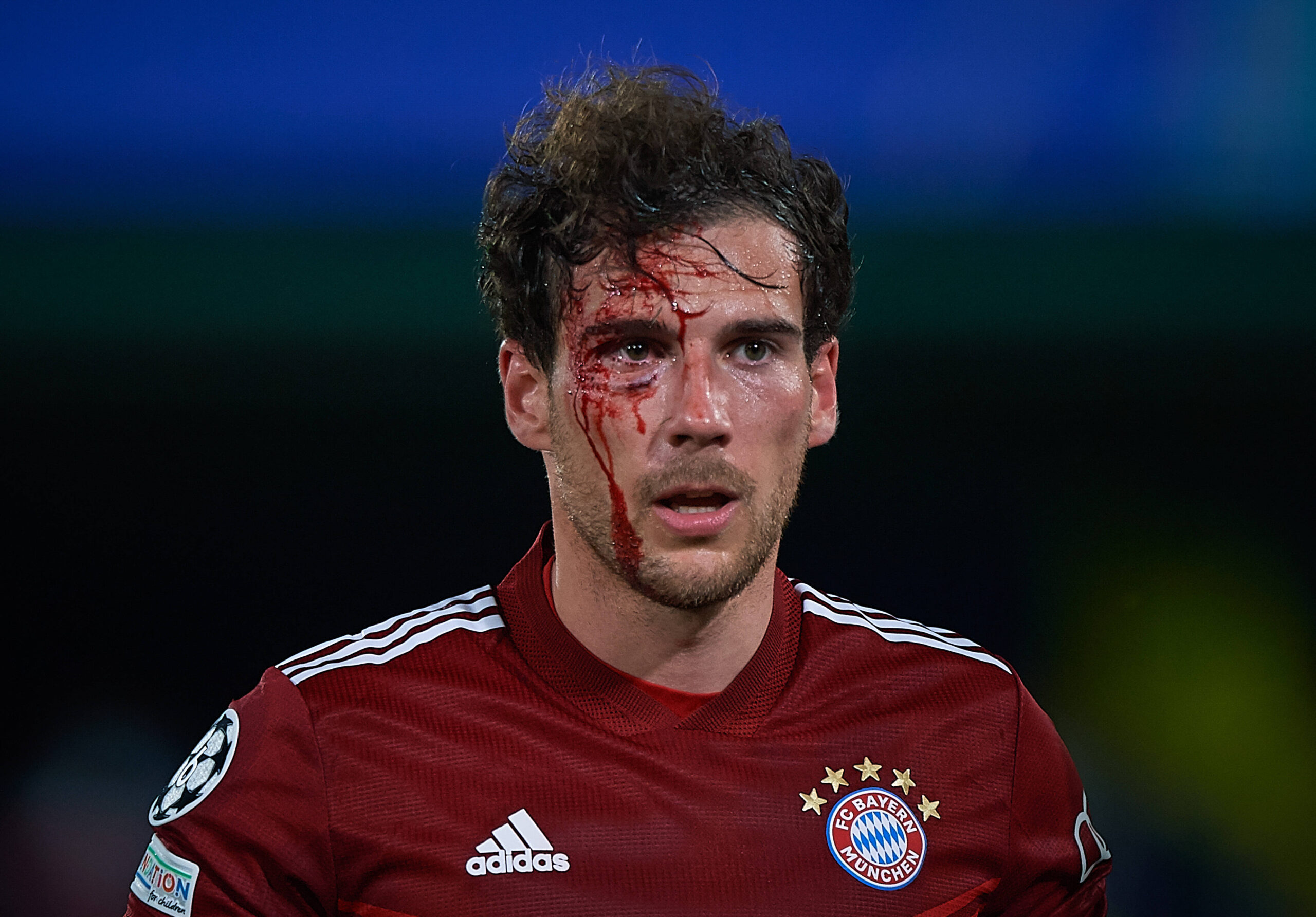 Bayern Mittelfeldspieler Leon Goretzka blutet an seinem rechten Auge