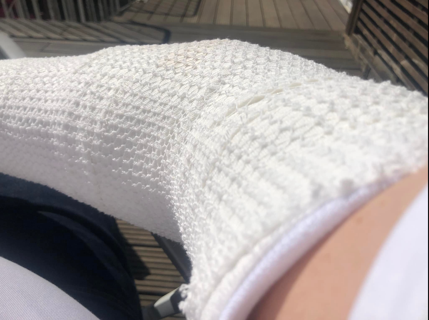Am Sonntagnachmittag postete Jens Kerstan ein Bild von seinem verbundenen rechten Arm auf Facebook.