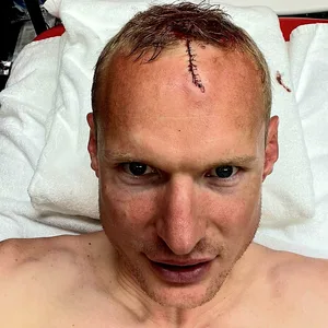 Sebastian Rode mit riesen Narbe am Kopf