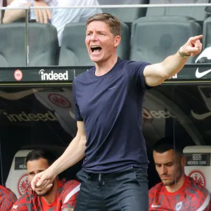 Eintracht-Trainer Glasner ärgert sich über Vorwürfe