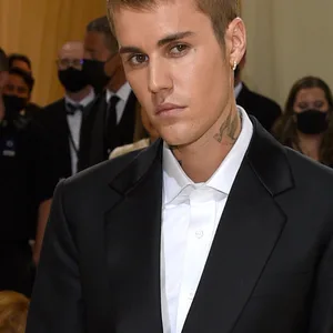 Justin Bieber hat Gesichtslähmung
