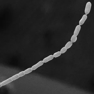 Thiomargarita magnifica, das wohl größte Bakterium der Welt