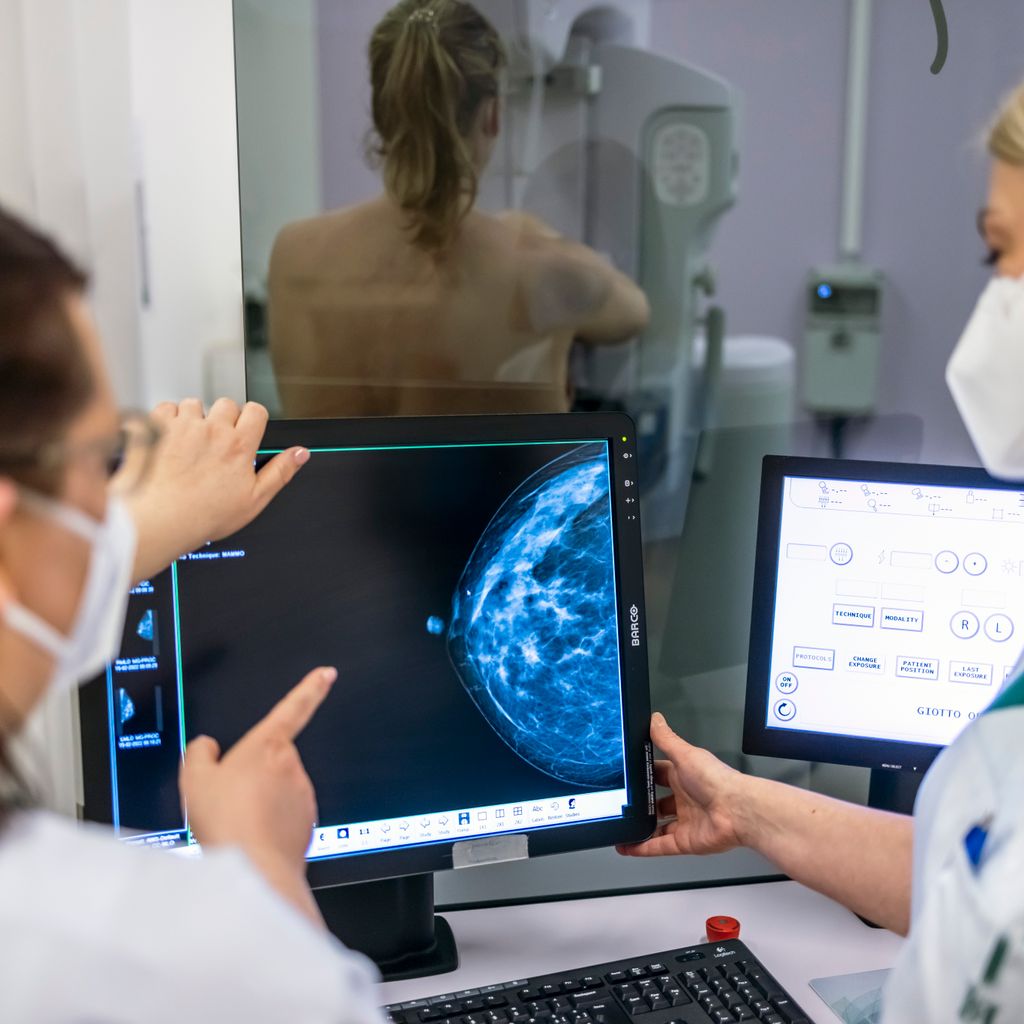 Ärztinnen untersuchen mit einer Mammografie die Brust einer Frau auf Brustkrebs.