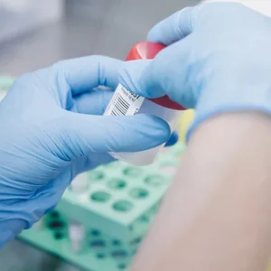 Eine Person führt im Labor einen PCR-Test auf Affenpocken durch.