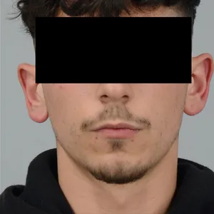 Fahndungsfoto eines dunkelhaarigen Mannes, Gesicht verpixelt