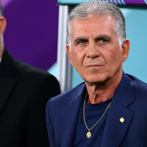 Carlos Queiroz schaut grimmig.