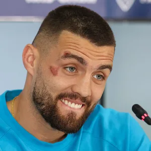 Mateo Kovacic mit Wunden am Gesicht
