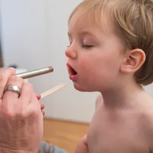 Die Krankenkasse Barmer meldet steigende Scharlach-Infektionen bei Kindern.
