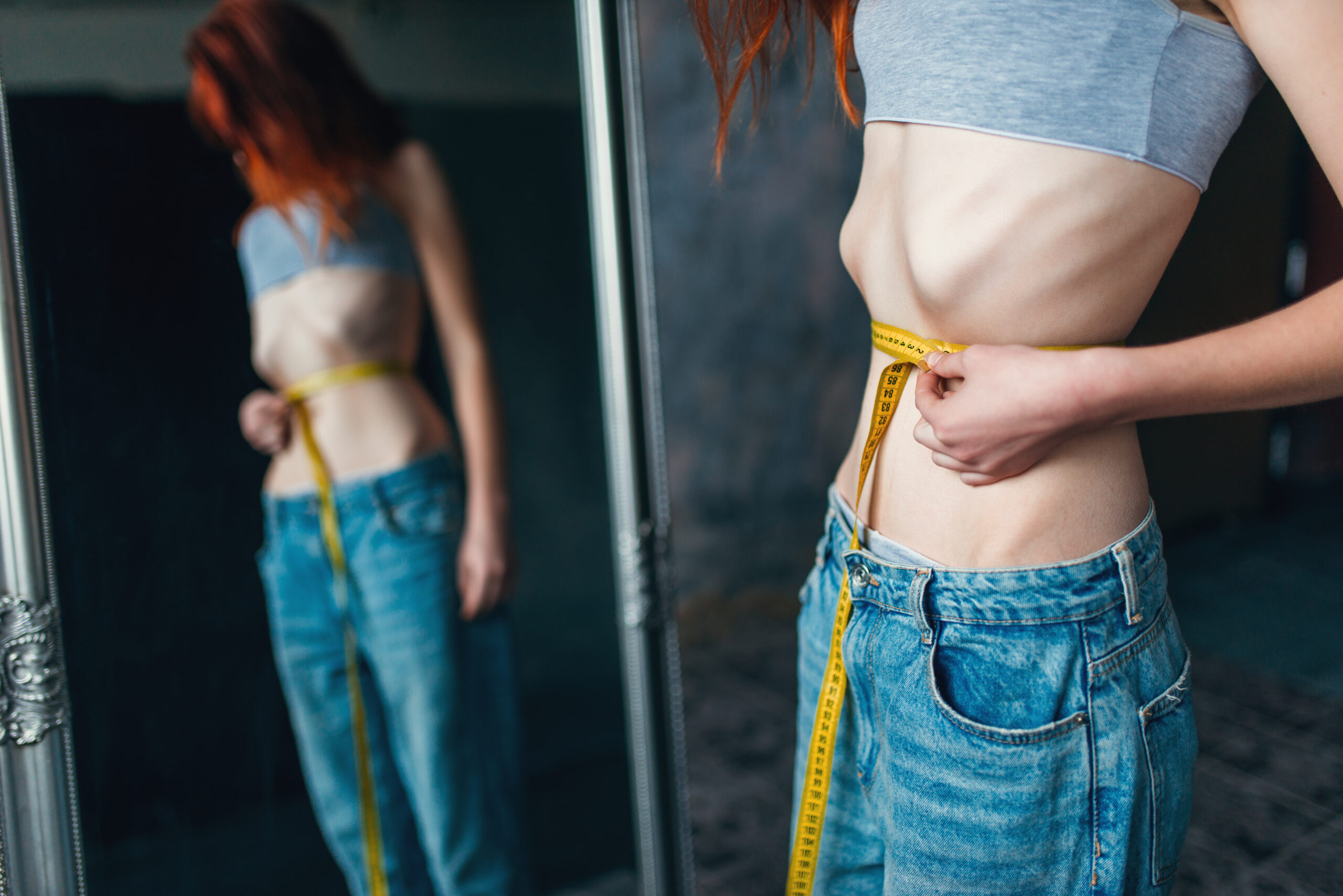 Magersucht Symbolbild (eine junge, sehr dünne Frau mit einem Zentimetermaß um ihren Bauch