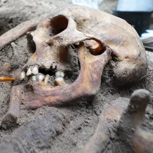 Nahaufnahme eines teilweise freigelegten Totenschädels in der Grabungsstelle