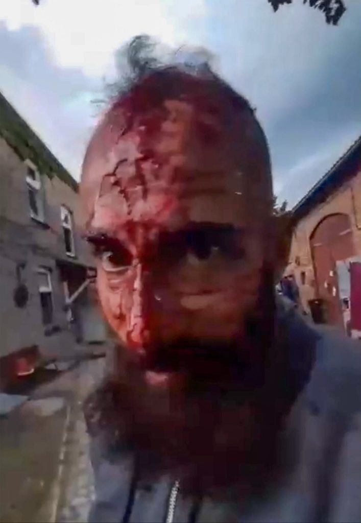 Der blutüberströmte Disli K. nach der Attacke