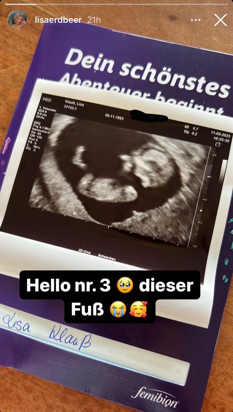 Dieses Ultraschall-Foto postete Gzuz-Gattin Lisa Krauß auf Instagram.