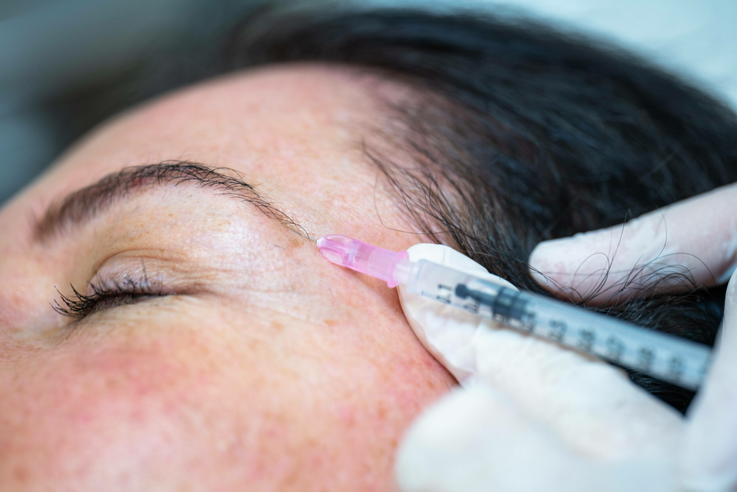 Einer Frau wird Botox gespritzt