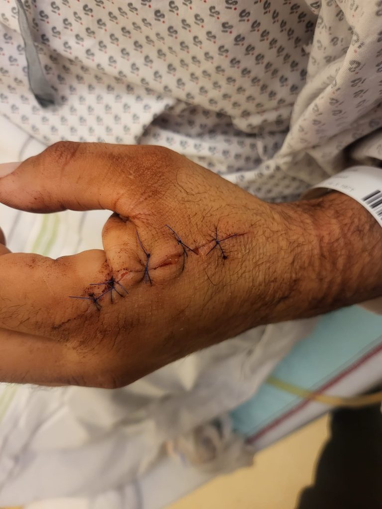 Durch das Abwehren des Angriffs wurde Souma schwer verletzt.