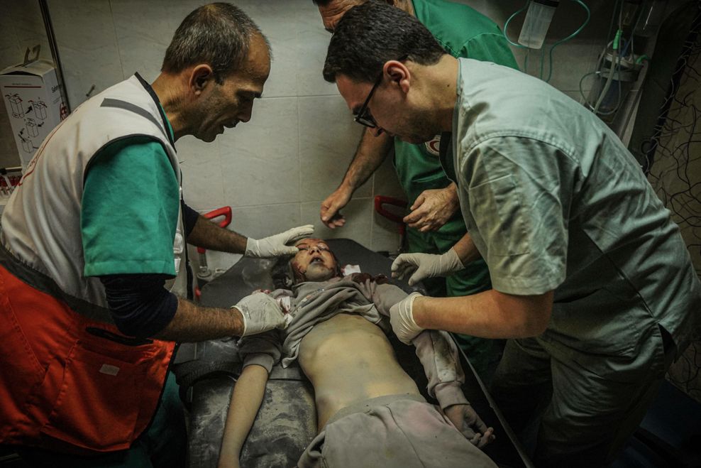 Palästinensisches Kind, das bei einem israelischen Bombenangriff verletzt wurde.