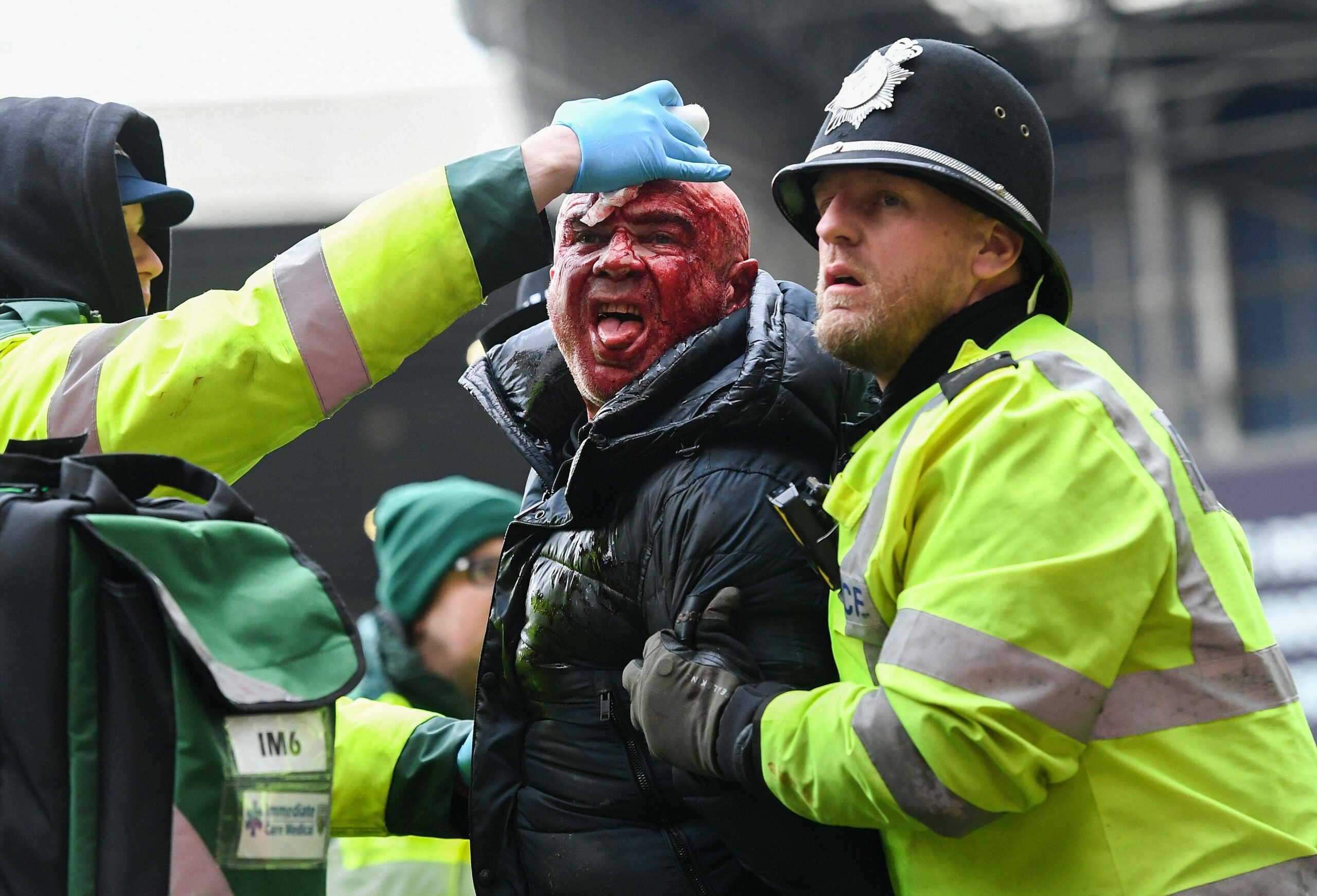 Ein blutüberströmter Fan beim Spiel West Bromwich Albion gegen die Wolverhampton Wanderers
