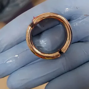 Diesen massiven Penisring musste die Feuerwehr mit einer Metallsäge entfernen.