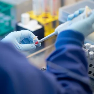 Eine Mitarbeiterin im Labor