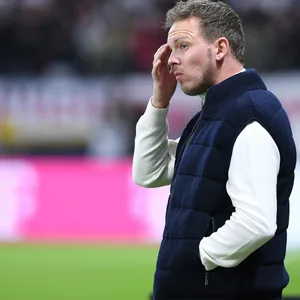 Julian Nagelsmann nachdenklich