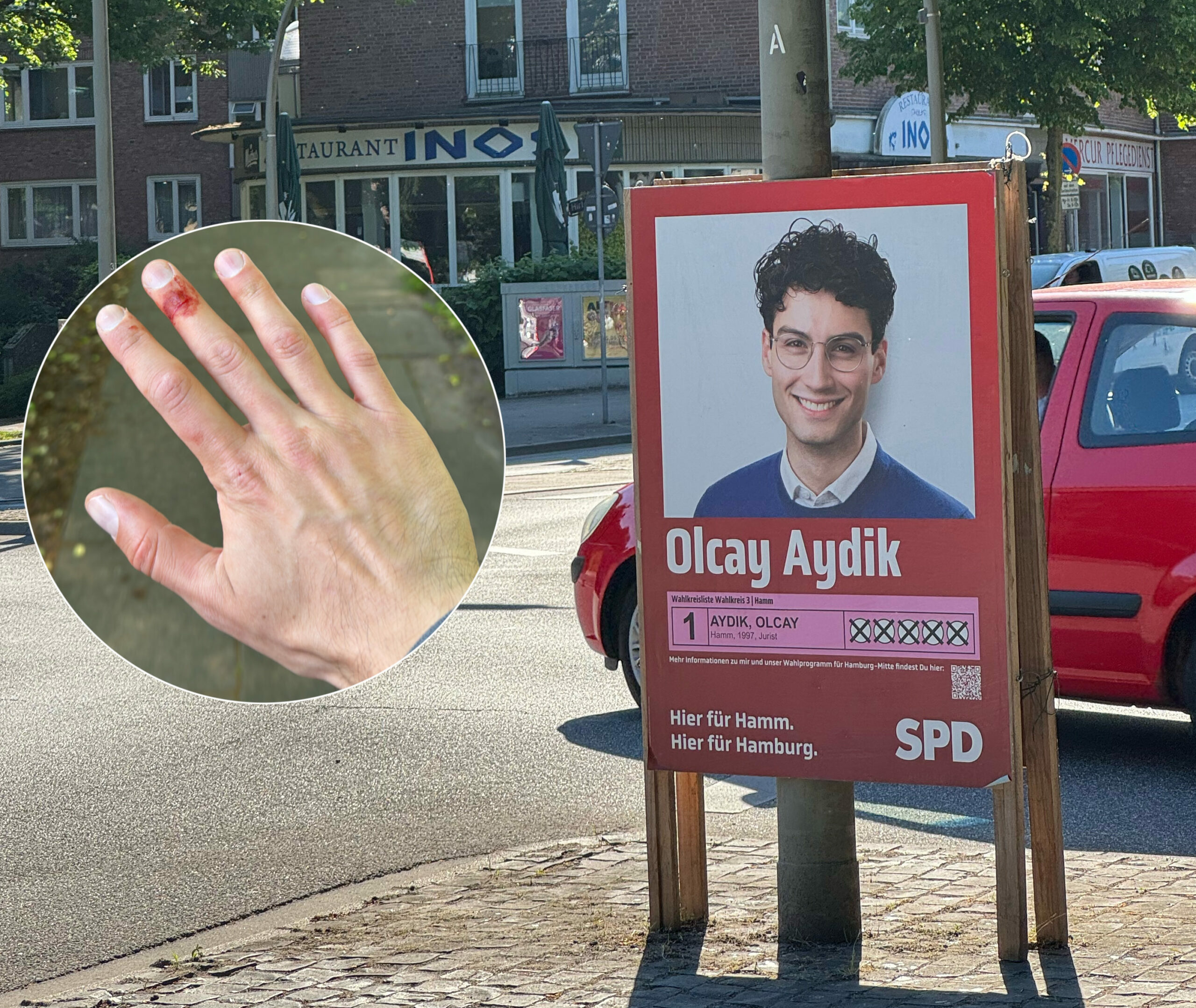 Als er versucht, heruntergerissene Wahlplakate wieder aufzustellen, schneidet sich der SPD-Mann Olcay Aydik an einer Rasierklinge, die Unbekannte am Plakat befestigt hatten.