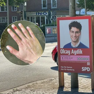 Als er versucht, heruntergerissene Wahlplakate wieder aufzustellen, schneidet sich der SPD-Mann Olcay Aydik an einer Rasierklinge, die Unbekannte am Plakat befestigt hatten.