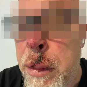 Das Opfer postete bei Facebook ein Foto seiner Verletzungen.