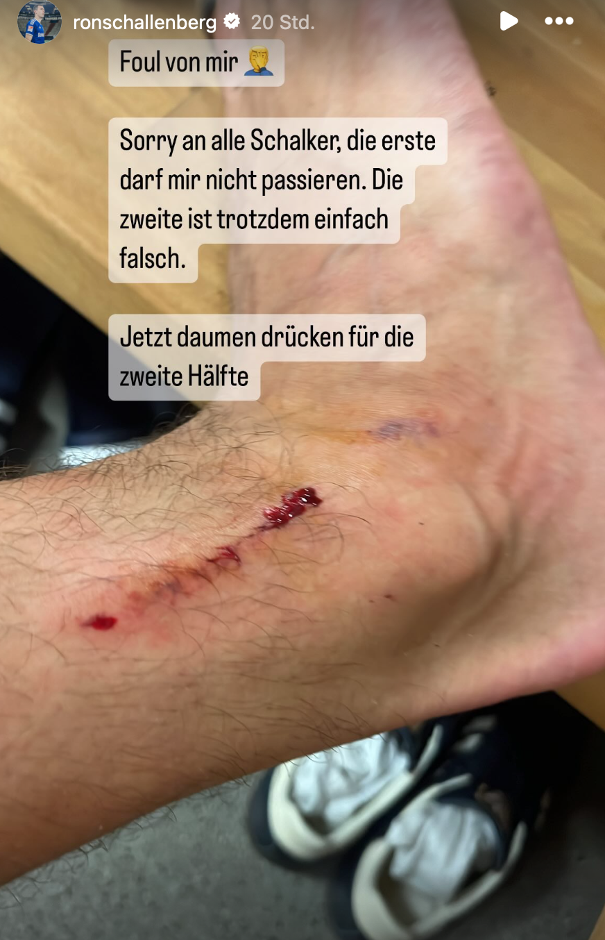 Insta-Story von Ron Schallenberg nach seinem Platzverweis