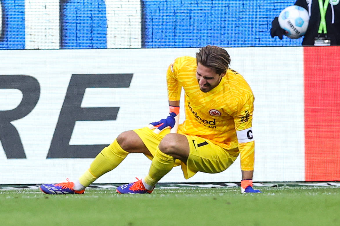 Kevin Trapp verletzt sich beim Frankfurter Sieg in Wolfsburg