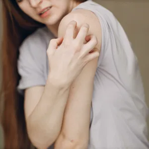 Eine Frau in einem kurzärmligen Shirt kratzt sich den Oberarm