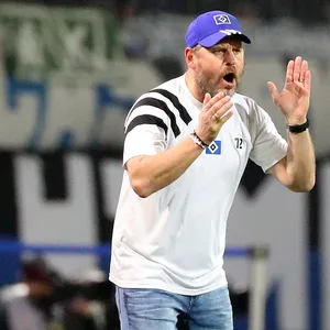 Da fehlt doch was! HSV-Trainer Steffen Baumgart zeigte sich in Braunschweig mit verändertem Outfit.