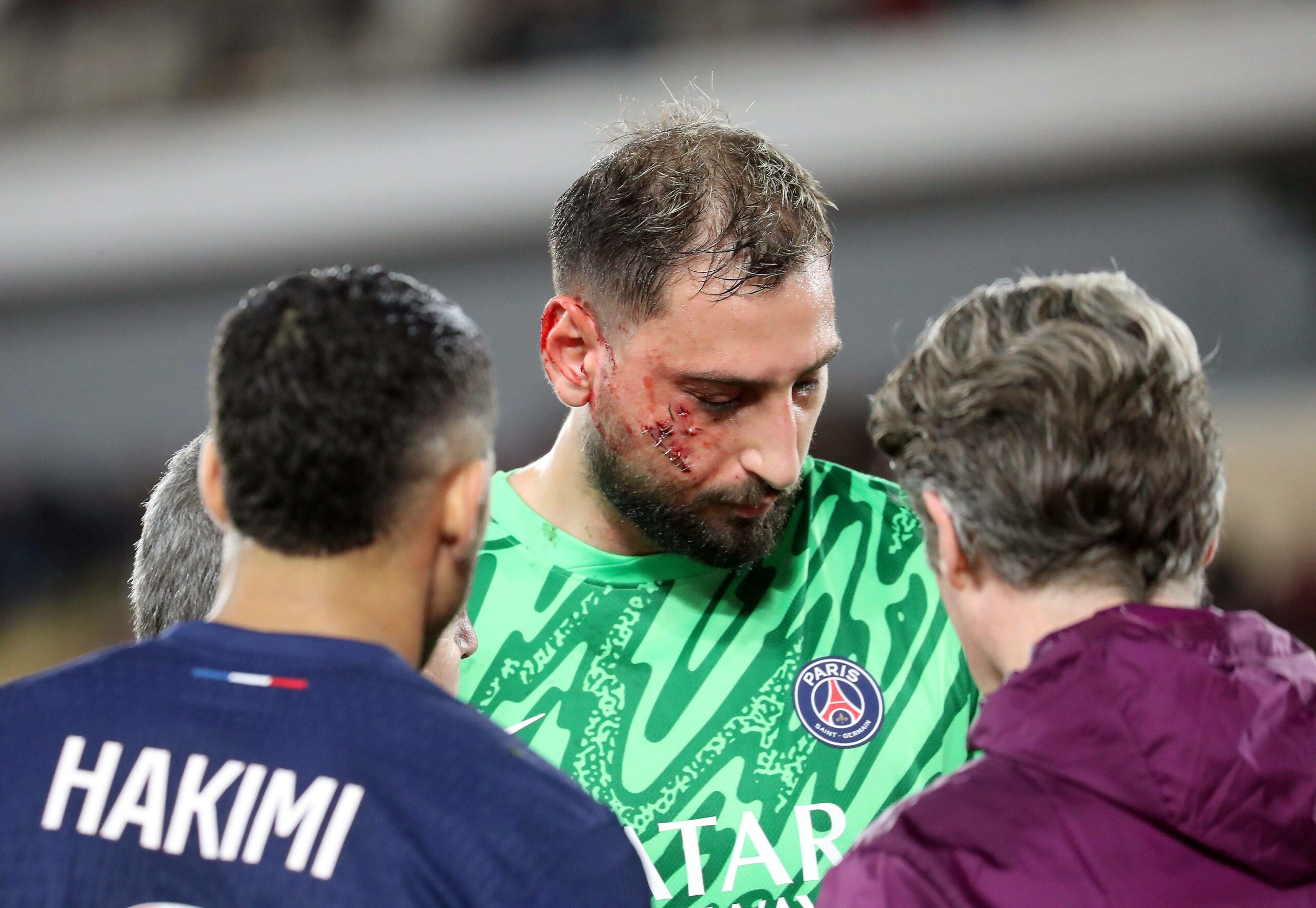 Gianluigi Donnarumma wird von Paris-Betreuern im Gesicht behandelt.