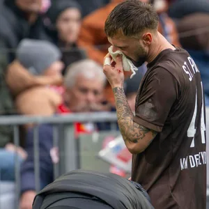 Siebe van der Heyden versucht, sein Nasenbluten zu stoppen.