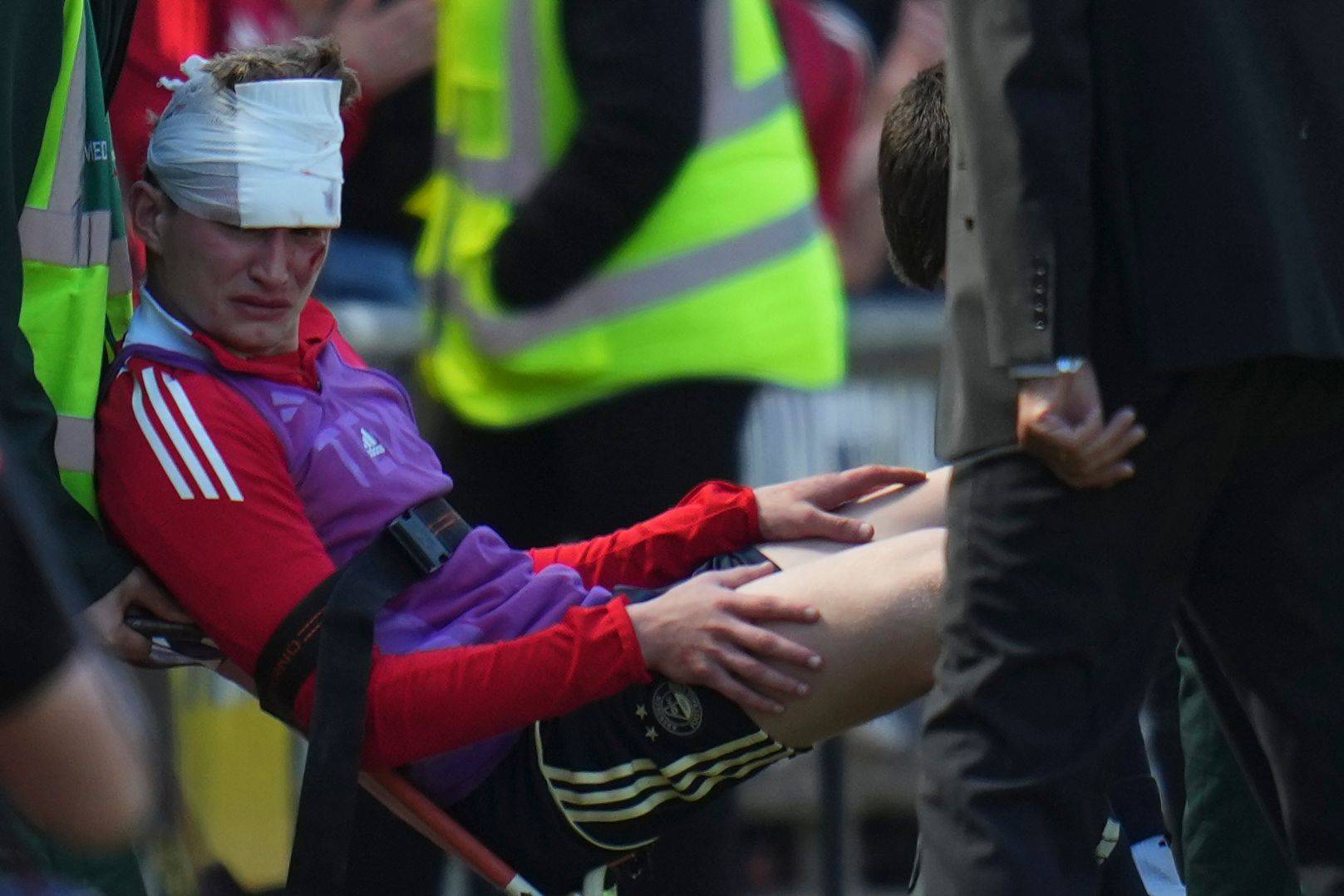 Jack Mackenzie mit einer Kopfbandage