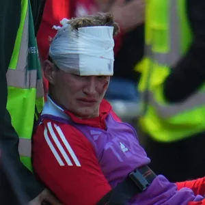 Jack Mackenzie mit einer Kopfbandage